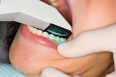 digitale Erfassung der Zahnsituation